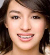 Orthodontics